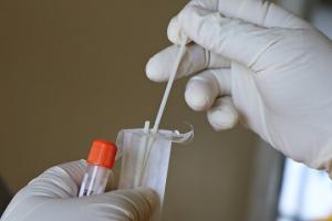 Kemenkes Tetapkan Tarif Tertinggi PCR Jawa-Bali Jadi Rp275 Ribu