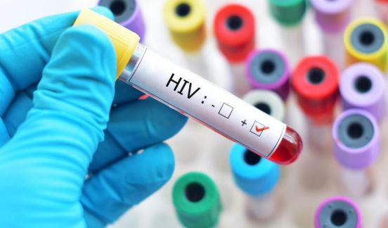 Operasi Pekat Amankan Puluhan Miras dan Belasan PSK, 3 Positif HIV